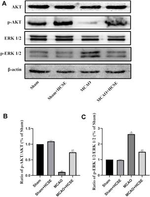 A Network-Based Approach to Investigate the Neuroprotective Effects and Mechanisms of Action of Huangqi-Chuanxiong and Sanleng-Ezhu Herb Pairs in the Treatment of Cerebral Ischemic Stroke